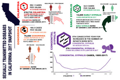 HIV/AIDS Symptoms