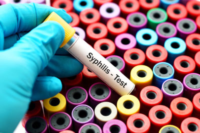 Hepatitis Symptoms